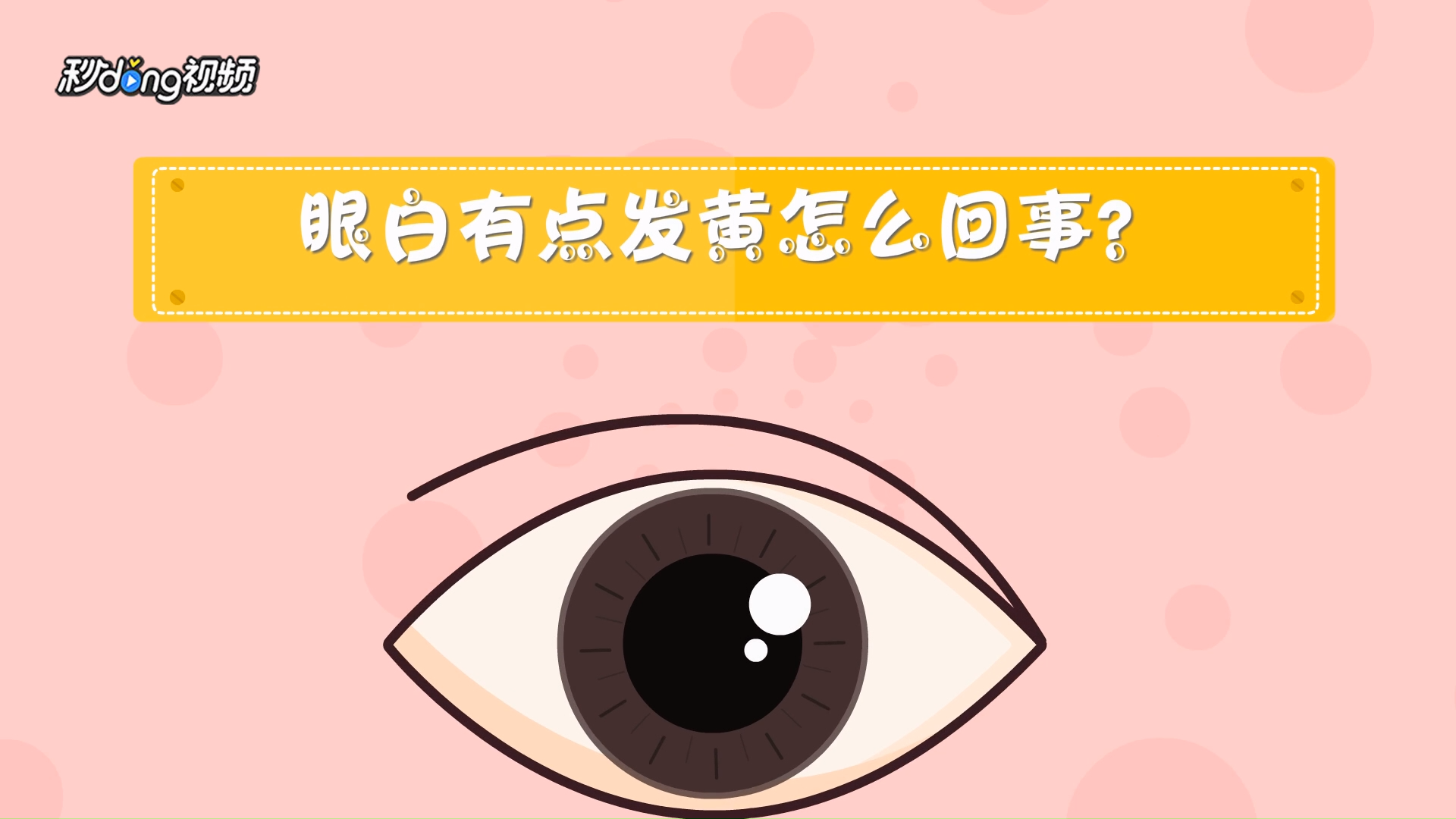 眼白有点发黄怎么回事?