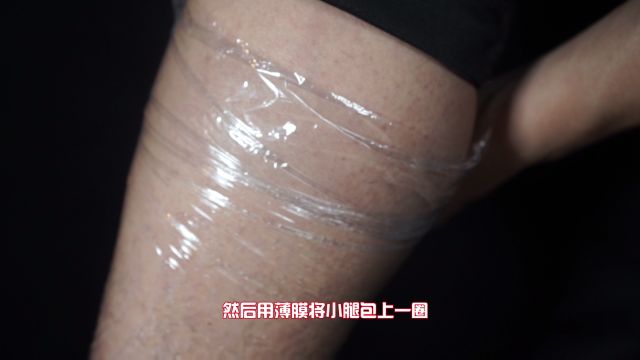 鱼鳞病的症状鱼鳞病图片 百度经验